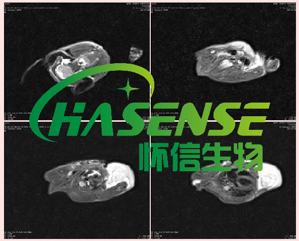 核磁共振(MRI)